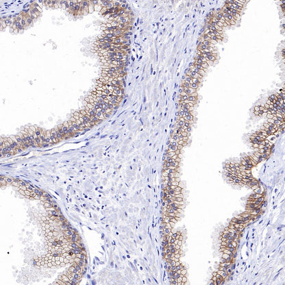 Desmocollin-2/3(DSC2/3) Recombinant Rabbit mAb (SDT-2102-59)