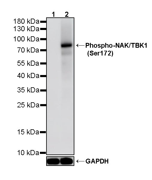 Phospho-TBK1/NAK (Ser172) Recombinant Rabbit mAb (S-5532)