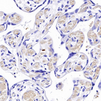 Hemoglobin alpha Recombinant Rabbit mAb (S-R242)