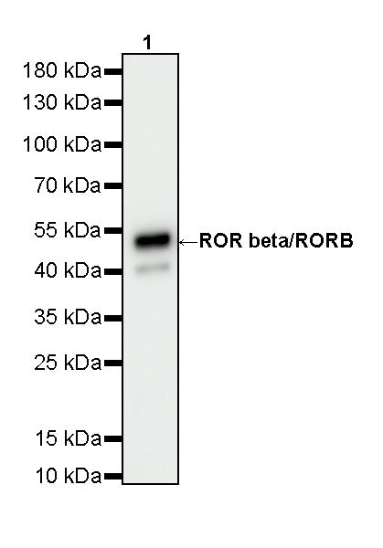 ROR beta/RORB Recombinant Rabbit mAb (S-5483)