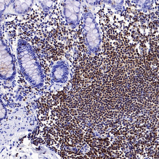 PIK3CD Recombinant Rabbit mAb (SDT-1978-148)