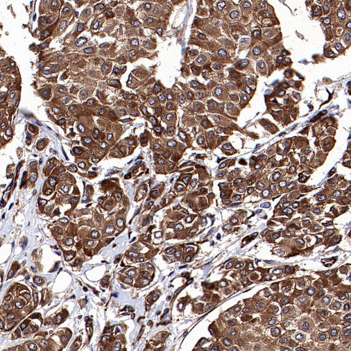 GSPT1 Recombinant Rabbit mAb (S-1914-49)