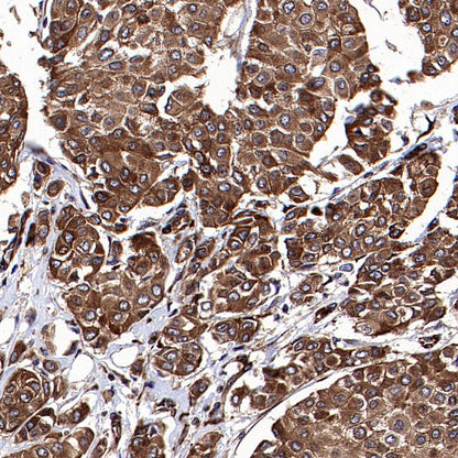 GSPT1 Recombinant Rabbit mAb (S-1914-49)