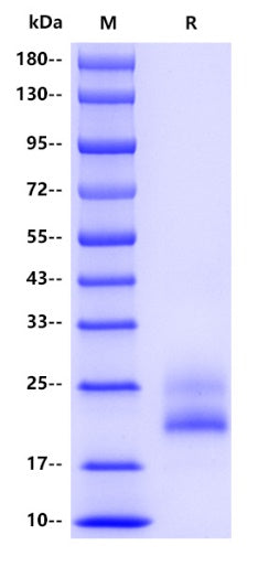 Human CD69 Protein, His tag