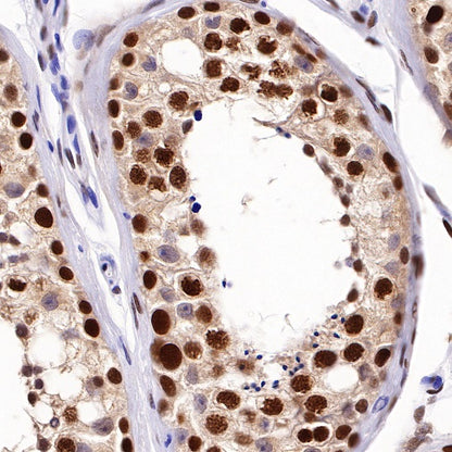 PCNA Recombinant Rabbit mAb (SDT-297-116)