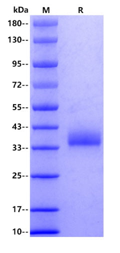 SARS-CoV-2 (BA.2.86/Omicron) RBD (V483del), His tag