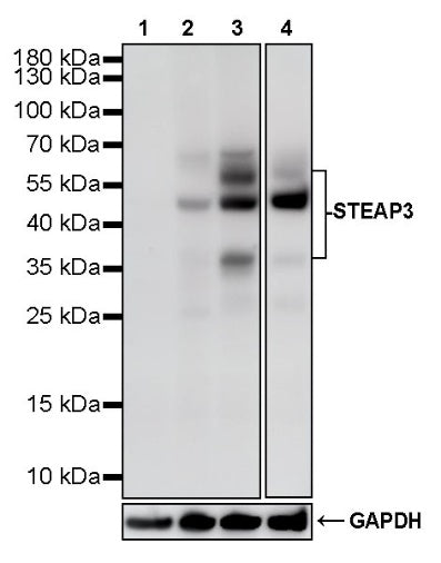 STEAP3 Recombinant Rabbit mAb (S-4466-26)