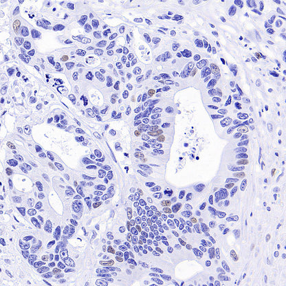 Cyclin E2 Recombinant Rabbit mAb (S-5247)