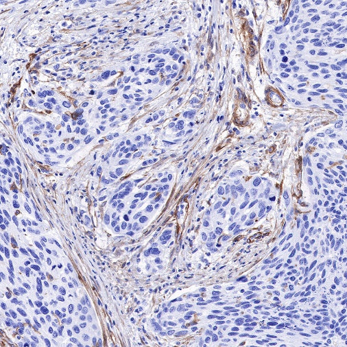 PDGFRA+PDGFRB Recombinant Rabbit mAb (S-393-11)