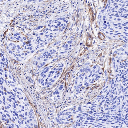 PDGFRA+PDGFRB Recombinant Rabbit mAb (S-393-11)