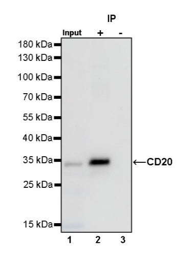 CD20 Recombinant Rabbit mAb (SDT-038-205)