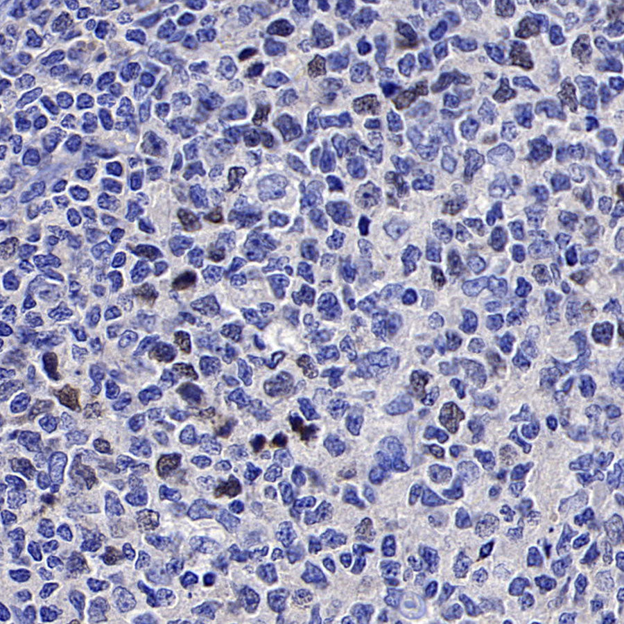 CENP-F Recombinant Rabbit mAb (S-3148-75)