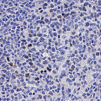 CENP-F Recombinant Rabbit mAb (S-3148-75)