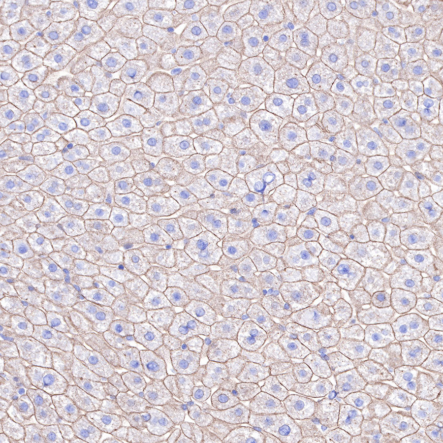 S-RMab® Keratin 18 Recombinant Rabbit mAb (SDT-012-7)