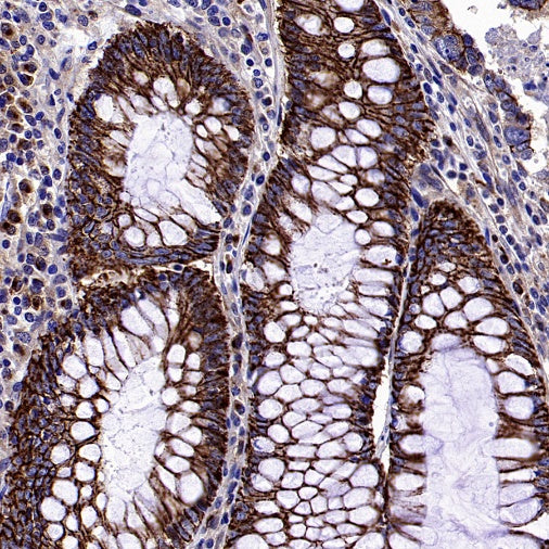 GORASP2 Recombinant Rabbit mAb (S-2526-47)