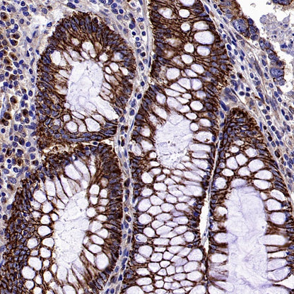 GORASP2 Recombinant Rabbit mAb (S-2526-47)