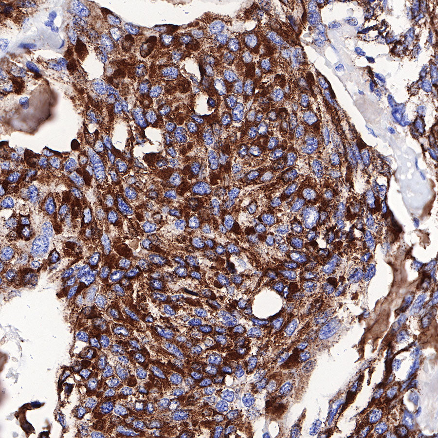 S-RMab® Chromogranin A Recombinant Rabbit mAb (SDT-074-57)