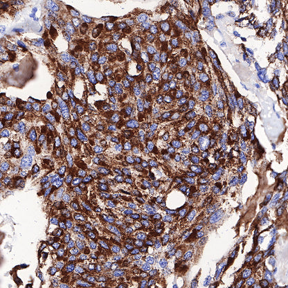 S-RMab® Chromogranin A Recombinant Rabbit mAb (SDT-074-57)