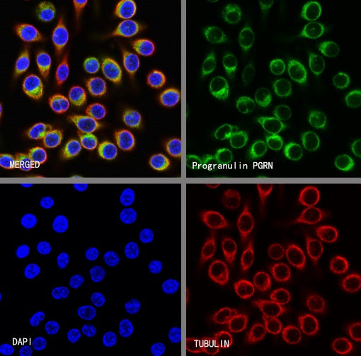 Progranulin/PGRN Recombinant Rabbit mAb (S-1090-110)