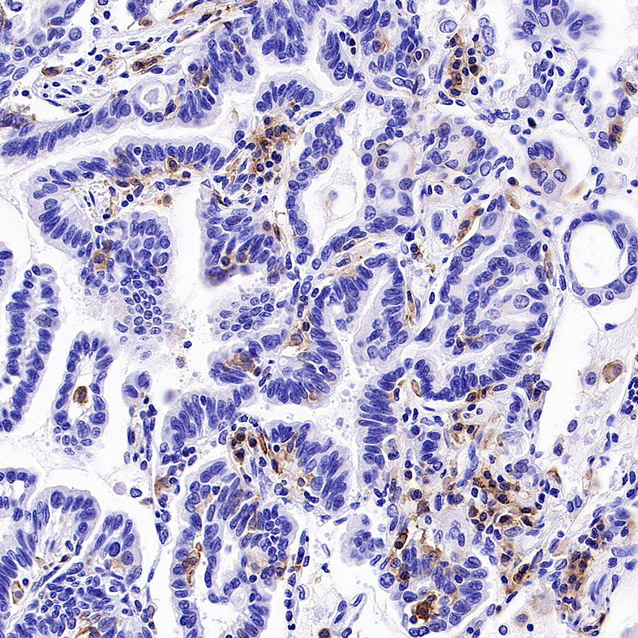 LILRB1 Recombinant Rabbit mAb (S-5001)