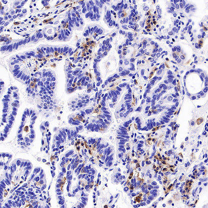 LILRB1 Recombinant Rabbit mAb (S-5001)