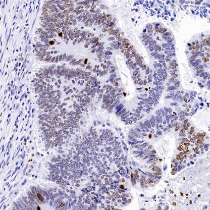 Phospho-Histone H3 (Ser28) Recombinant Rabbit mAb (S-1025-45)