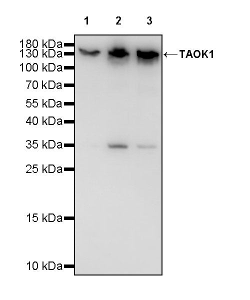 TAOK1 Recombinant Rabbit mAb (S-3673-80)
