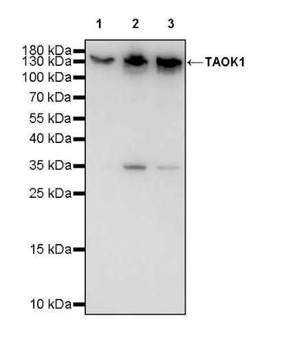 TAOK1 Recombinant Rabbit mAb (S-3673-80)
