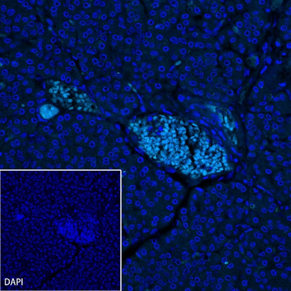 NKX6.1 Recombinant Rabbit mAb (S-260-31)
