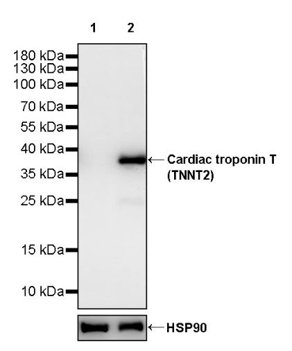 Cardiac troponin T (TNNT2) Recombinant Rabbit mAb (SDT-2894-34)