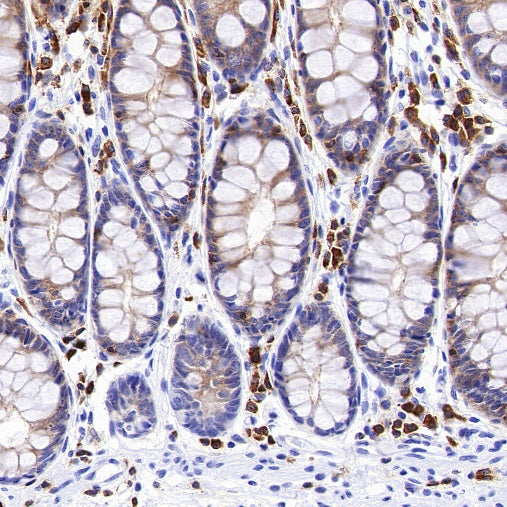 Ezrin Recombinant Rabbit mAb (S-1894-4)
