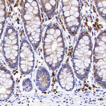 Ezrin Recombinant Rabbit mAb (S-1894-4)