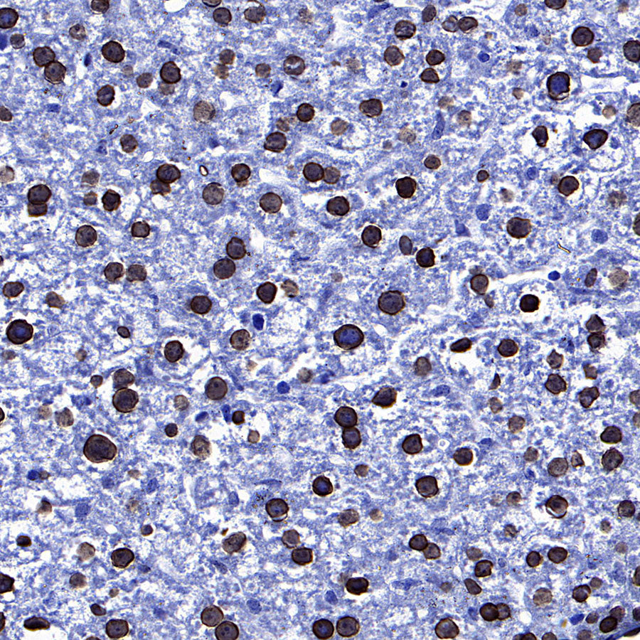 Lamin A/C Recombinant Rabbit mAb (S-5671)