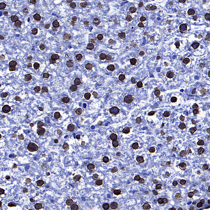 Lamin A/C Recombinant Rabbit mAb (S-5671)