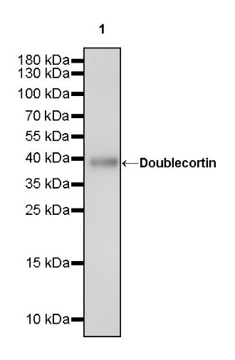 Doublecortin Recombinant Rabbit mAb (S-1234-3)