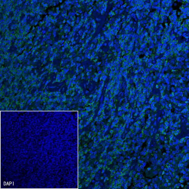 Mouse Anti-Human CD45RO Antibody (UCHL1)