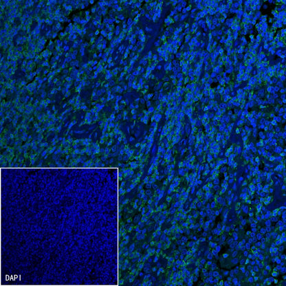 Mouse Anti-Human CD45RO Antibody (UCHL1)