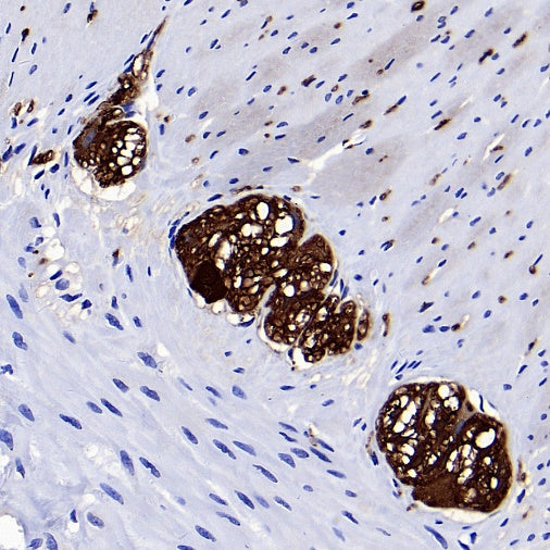 UCHL1 Rabbit Polyclonal Antibody