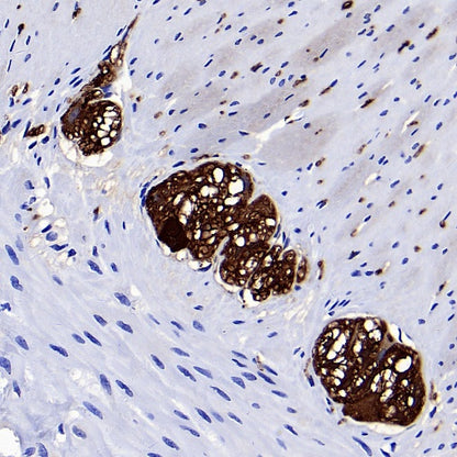 UCHL1 Rabbit Polyclonal Antibody