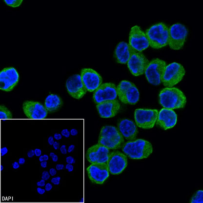 TUBA1B Rabbit Polyclonal Antibody