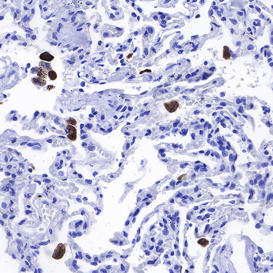 iNOS Recombinant Rabbit mAb (SDT-R131)
