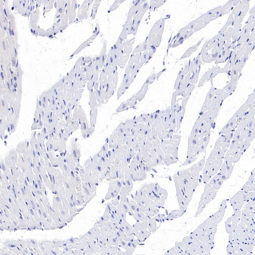 CYP11A1 Rabbit Polyclonal Antibody