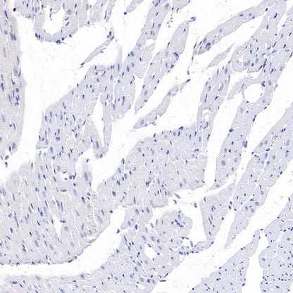 CYP11A1 Rabbit Polyclonal Antibody