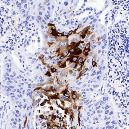 CK-13 Recombinant Rabbit mAb (SDT-R282)