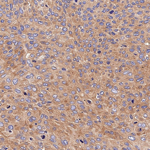 PKM Recombinant Rabbit mAb (S-812-20)