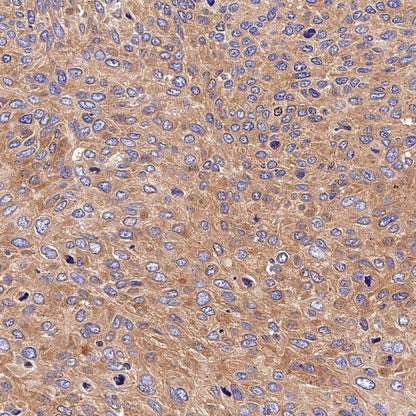 PKM Recombinant Rabbit mAb (S-812-20)