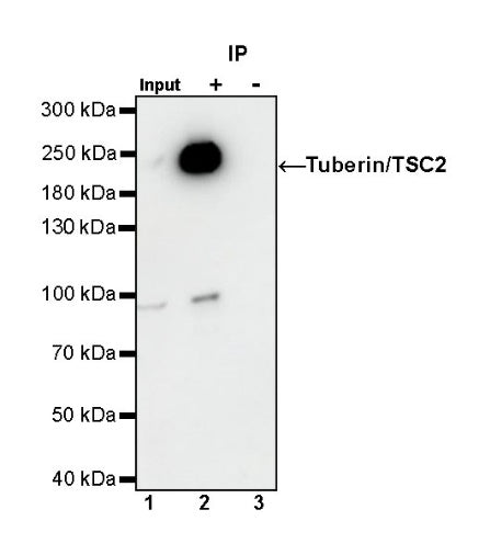 Tuberin/TSC2 Recombinant Rabbit mAb (S-1138-125)