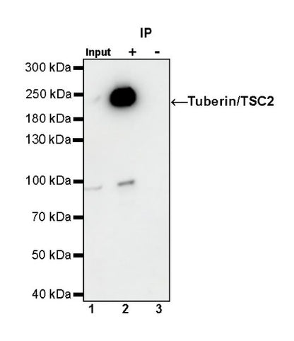 Tuberin/TSC2 Recombinant Rabbit mAb (S-1138-125)