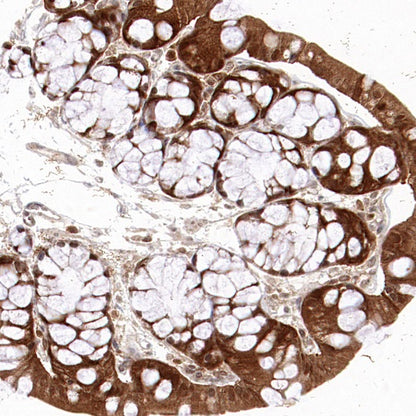 ASC/TMS1 Rabbit Polyclonal Antibody