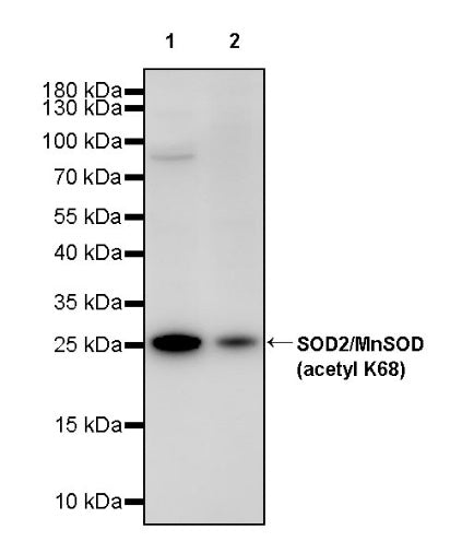 SOD2/MnSOD (acetyl K68) Rabbit Polyclonal Antibody